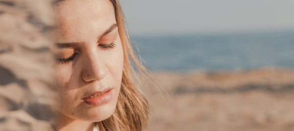 Los efectos del verano y el sol sobre el acné